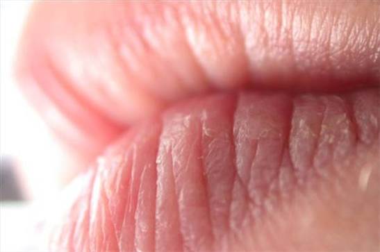 How To Prevent Lips From Being Dry And Chapped