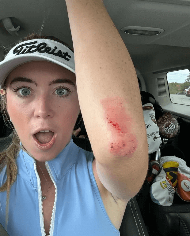 Last week, she sent her fans into meltdown with a daring top before revealing a nasty course injury.