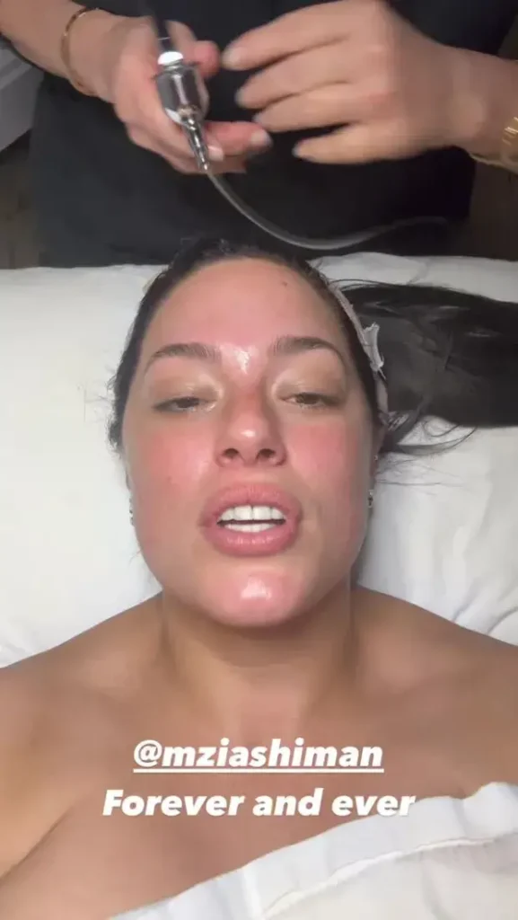 During a cosmetic procedure in New York City, Ashley Graham lies topless under a towel on her Instagram Stories and showed fans the behind-the-scenes process.