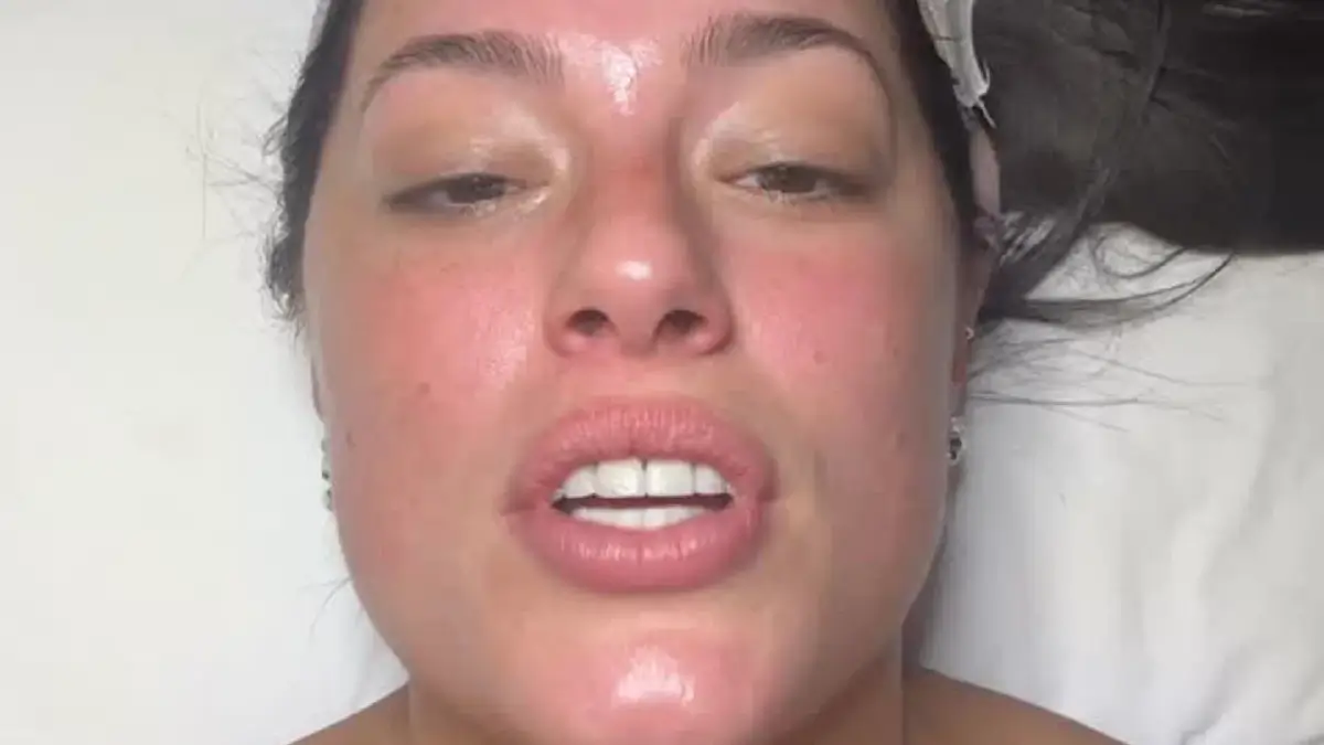At a spa in NYC, Ashley Graham lies topless under a towel while she receives a cosmetic procedure