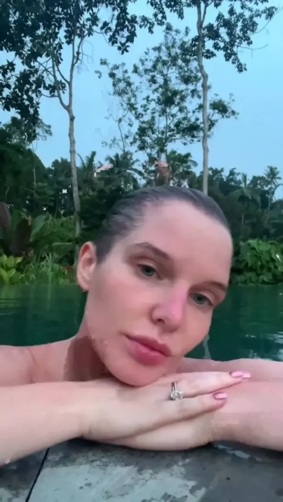 In a topless pool dip while on vacation with her children, Helen Flanagan showed off her "burnt boobs"